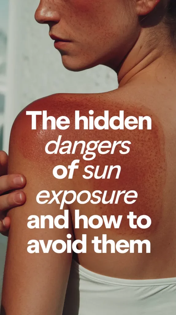 Sun Exposure Dangers: What Helped Me Protect My Skin in 2025